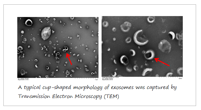 Exosome